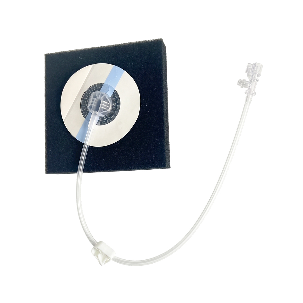 Negative Pressure Vulnus Therapy
